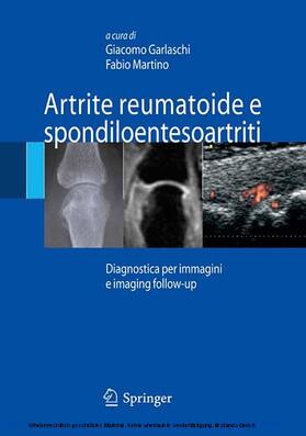 Garlaschi / Martino |  Artrite reumatoide e spondiloentesoartriti | eBook | Sack Fachmedien