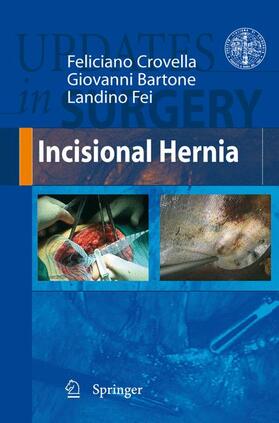 Crovella / Fei / Bartone |  Incisional Hernia | Buch |  Sack Fachmedien