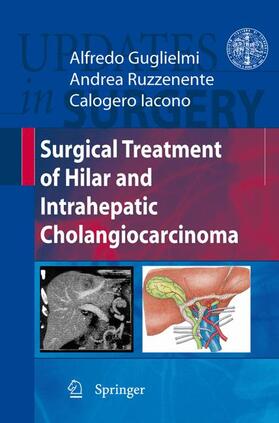 Guglielmi / Ruzzenente / Iacono |  Surgical Treatment of Hilar and Intrahepatic Cholangiocarcinoma | Buch |  Sack Fachmedien