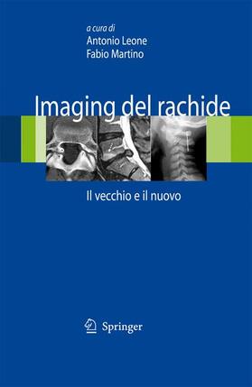Leone / Martino |  Imaging del Rachide | Buch |  Sack Fachmedien