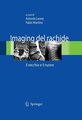Leone / Martino |  Imaging del rachide | eBook | Sack Fachmedien