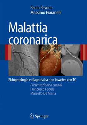 Pavone / Fioranelli |  Malattia Coronarica | Buch |  Sack Fachmedien