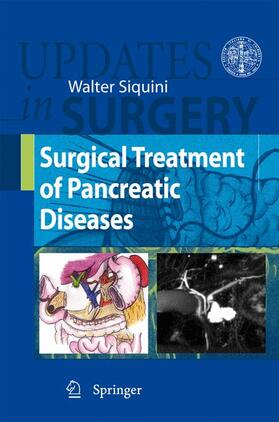 Siquini |  Surgical Treatment of Pancreatic Diseases | Buch |  Sack Fachmedien