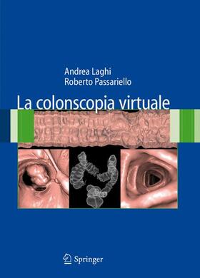 Laghi / Passariello |  La Colonscopia Virtuale | Buch |  Sack Fachmedien