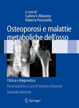 Passariello / Albanese |  Osteoporosi e malattie metaboliche dell'osso | Buch |  Sack Fachmedien