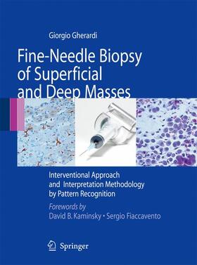 Gherardi |  Fine-Needle Biopsy of Superficial and Deep Masses | Buch |  Sack Fachmedien