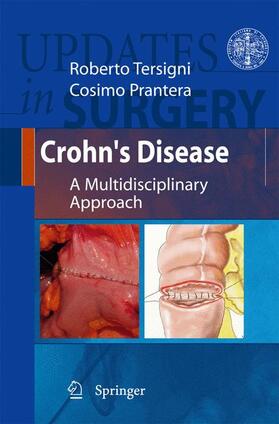 Prantera / Tersigni |  Crohn's Disease | Buch |  Sack Fachmedien