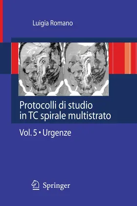 Romano |  Protocolli di studio in TC spirale multistrato | eBook | Sack Fachmedien