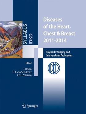 Hodler / Zollikofer / Schulthess |  Diseases of the Heart, Chest & Breast 2011-2014 | Buch |  Sack Fachmedien