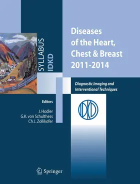 Hodler / Schulthess / Zollikofer |  Diseases of the Heart, Chest & Breast 2011-2014 | eBook | Sack Fachmedien