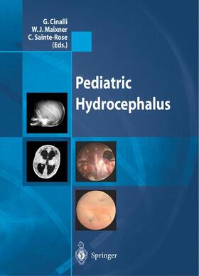 Cinalli / Sainte-Rose / Maixner |  Pediatric Hydrocephalus | Buch |  Sack Fachmedien