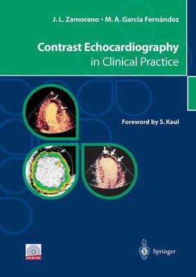 Zamorano / García Fernández |  Contrast Echocardiography in Clinical Practice | Buch |  Sack Fachmedien