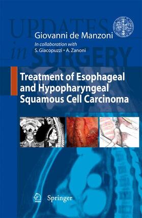 De Manzoni |  Treatment of Esophageal and Hypopharingeal Squamous Cell Carcinoma | Buch |  Sack Fachmedien