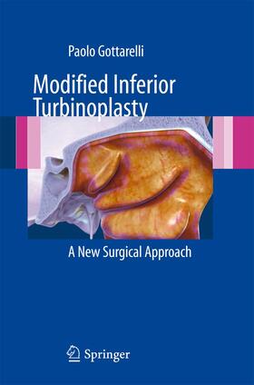 Gottarelli |  Modified Inferior Turbinoplasty | Buch |  Sack Fachmedien