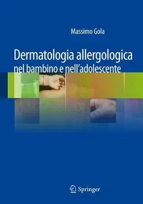 Gola |  Dermatologia allergologica nel bambino e nell'adolescente | Buch |  Sack Fachmedien