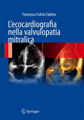 Faletra |  L'ecocardiografia nella valvulopatia mitralica | Buch |  Sack Fachmedien