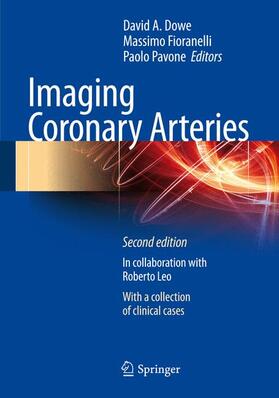 Dowe / Fioranelli / Pavone |  Imaging Coronary Arteries | Buch |  Sack Fachmedien