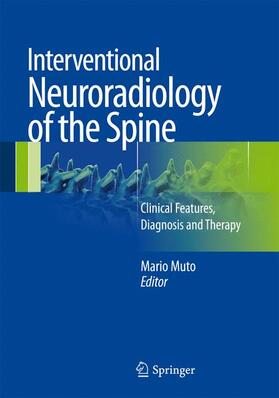 Muto |  Interventional Neuroradiology of the Spine | Buch |  Sack Fachmedien