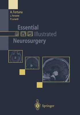 Fortuna / Lunardi / Ferrante |  Essential Illustrated Neurosurgery | Buch |  Sack Fachmedien