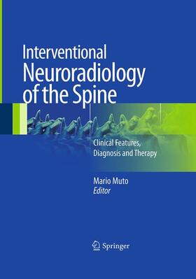 Muto |  Interventional Neuroradiology of the Spine | Buch |  Sack Fachmedien