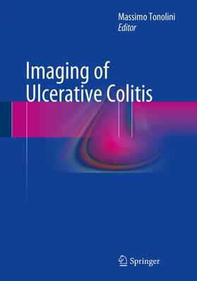 Tonolini |  Imaging of Ulcerative Colitis | Buch |  Sack Fachmedien