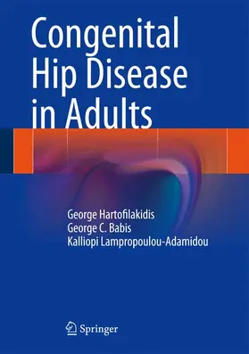 Hartofilakidis / Lampropoulou-Adamidou / Babis |  Congenital Hip Disease in Adults | Buch |  Sack Fachmedien