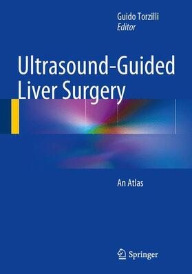 Torzilli | Ultrasound-Guided Liver Surgery | Buch | 978-88-470-5509-4 | sack.de