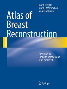 Rietjens / Lohsiriwat / Casales Schorr |  Atlas of Breast Reconstruction | Buch |  Sack Fachmedien