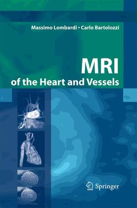 Lombardi / Bartolozzi |  MRI of the Heart and Vessels | Buch |  Sack Fachmedien