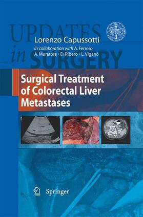 Capussotti |  Surgical Treatment of Colorectal Liver Metastases | Buch |  Sack Fachmedien