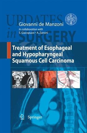 De Manzoni |  Treatment of Esophageal and Hypopharingeal Squamous Cell Carcinoma | Buch |  Sack Fachmedien