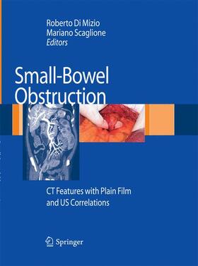 Scaglione / Di Mizio |  Small-Bowel Obstruction | Buch |  Sack Fachmedien