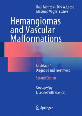 Mattassi / Vaghi / Loose |  Hemangiomas and Vascular Malformations | Buch |  Sack Fachmedien