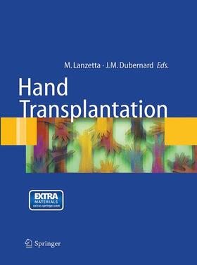 Lanzetta / Dubernard |  Hand transplantation | Buch |  Sack Fachmedien
