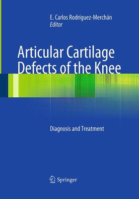 Rodrìguez-Merchán |  Articular Cartilage Defects of the Knee | Buch |  Sack Fachmedien
