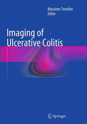 Tonolini |  Imaging of Ulcerative Colitis | Buch |  Sack Fachmedien