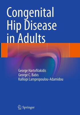 Hartofilakidis / Lampropoulou-Adamidou / Babis |  Congenital Hip Disease in Adults | Buch |  Sack Fachmedien