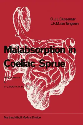 van Tongeren / Cluysenaer |  Malabsorption in Coeliac Sprue | Buch |  Sack Fachmedien