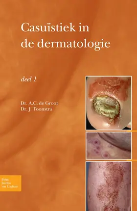 Groot / Toonstra |  Casuïstiek in de dermatologie - deel I | eBook | Sack Fachmedien