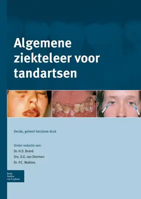 Brand / van Diermen / Makkes |  Algemene ziekteleer voor tandartsen | eBook | Sack Fachmedien