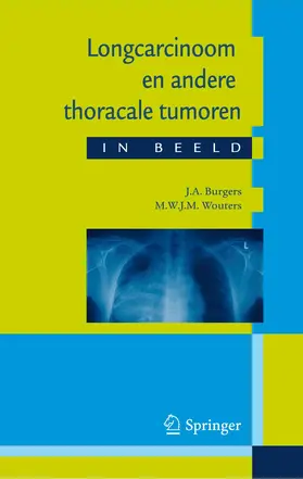 Burgers / Wouters |  Longcarcinoom en andere thoracale tumoren in beeld | eBook | Sack Fachmedien