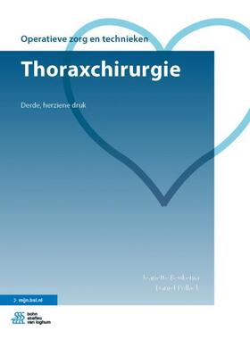 Beukema / Pollack |  Thoraxchirurgie | Buch |  Sack Fachmedien