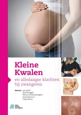 Eekhof / Bruggink / Scherptong-Engbers |  Kleine Kwalen en alledaagse klachten bij zwangeren | Buch |  Sack Fachmedien