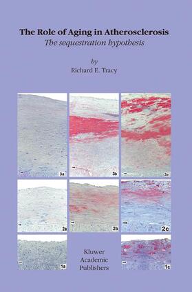 Tracy |  The Role of Aging in Atherosclerosis | Buch |  Sack Fachmedien