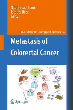 Huot / Beauchemin |  Metastasis of Colorectal Cancer | Buch |  Sack Fachmedien