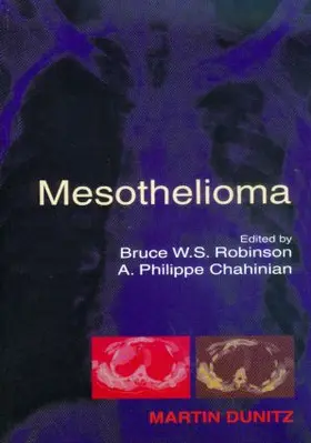 Robinson / Chahinian |  Mesothelioma | Buch |  Sack Fachmedien