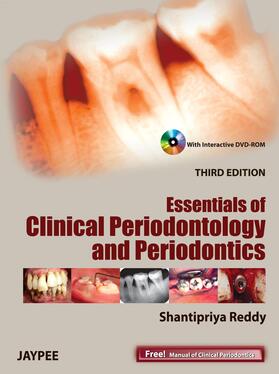 Reddy |  Essentials of Clinical Periodontology and Periodontics | Buch |  Sack Fachmedien