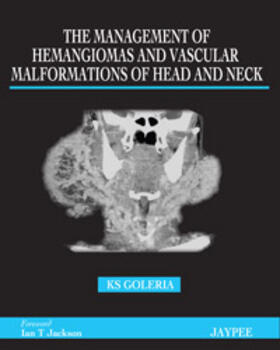 Goleria |  The Management of Haemangiomas and Vascular Malformations of Head and Neck | Buch |  Sack Fachmedien