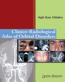 Chhabra |  Clinico-Radiological Atlas of Orbital Disorders | Buch |  Sack Fachmedien