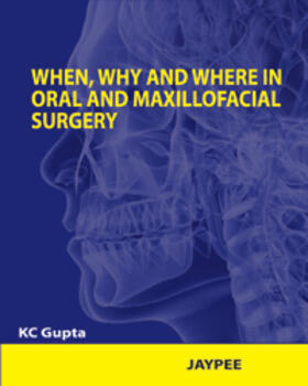 Gupta |  When, Why and Where in Oral and Maxillofacial Surgery | Buch |  Sack Fachmedien